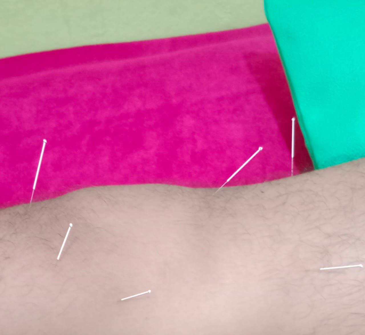 rumah bekam asy syifa